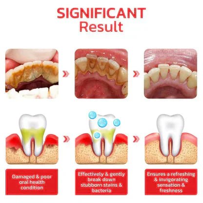Probiotic Ultra Whitening Toothpaste